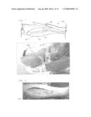 Method and System for Monitoring Oxygenation Levels of a Compartment for Detecting Conditions of a Compartment Syndrome diagram and image