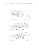 Method and System for Monitoring Oxygenation Levels of a Compartment for Detecting Conditions of a Compartment Syndrome diagram and image