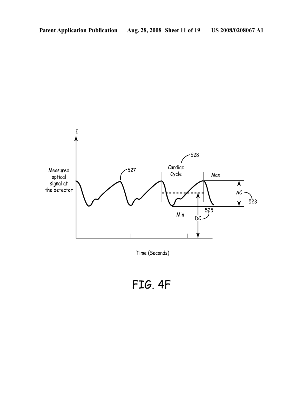 IMPLANTABLE TISSUE PERFUSION SENSING SYSTEM AND METHOD - diagram, schematic, and image 12