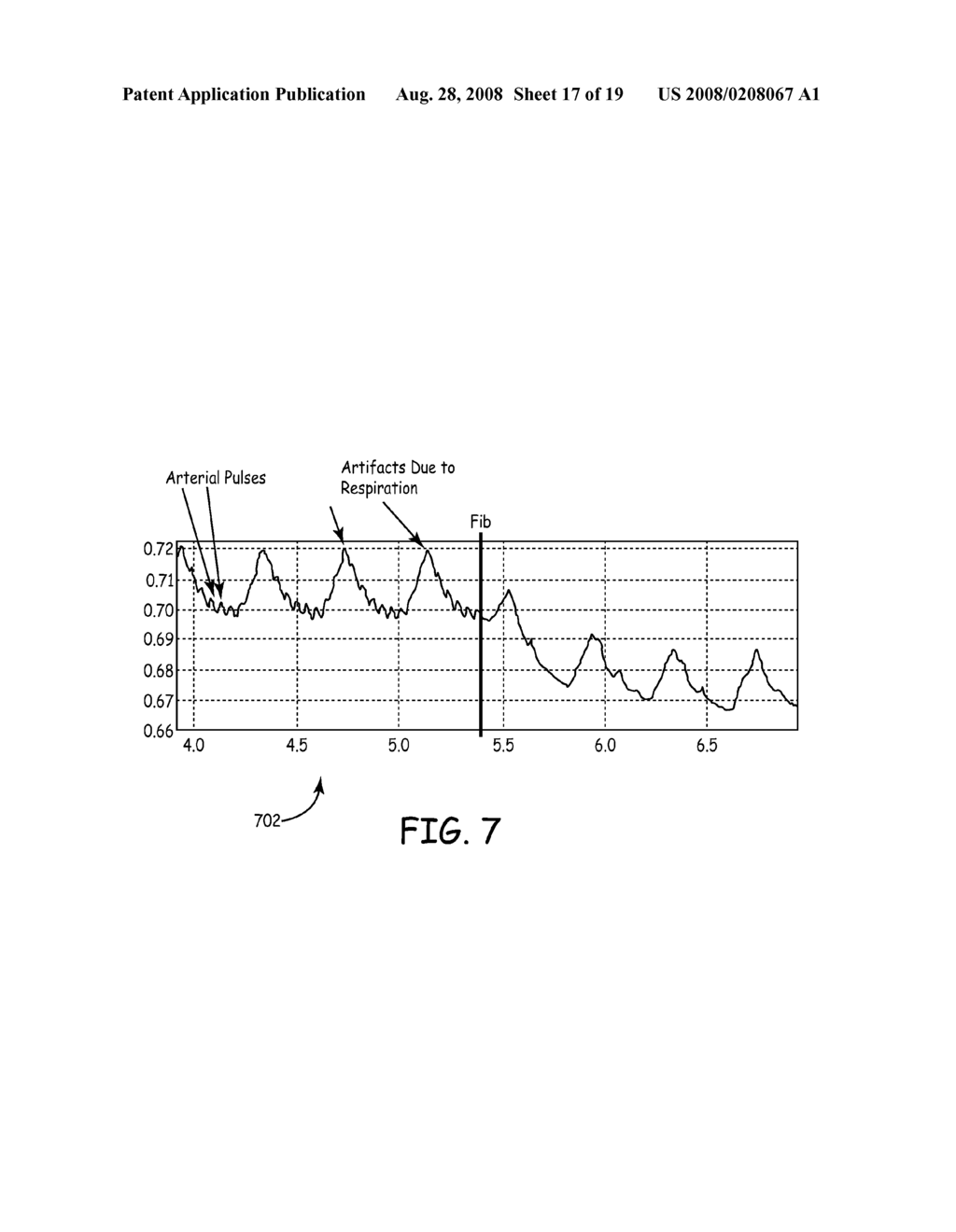 IMPLANTABLE TISSUE PERFUSION SENSING SYSTEM AND METHOD - diagram, schematic, and image 18