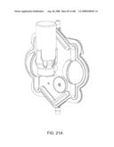 Pumping Cassette diagram and image