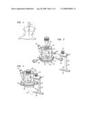 Apparatus for preparing a femur diagram and image