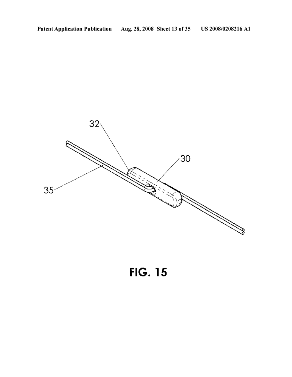 METHODS AND DEVICES FOR ENDOSCOPIC TREATMENT OF ORGANS - diagram, schematic, and image 14