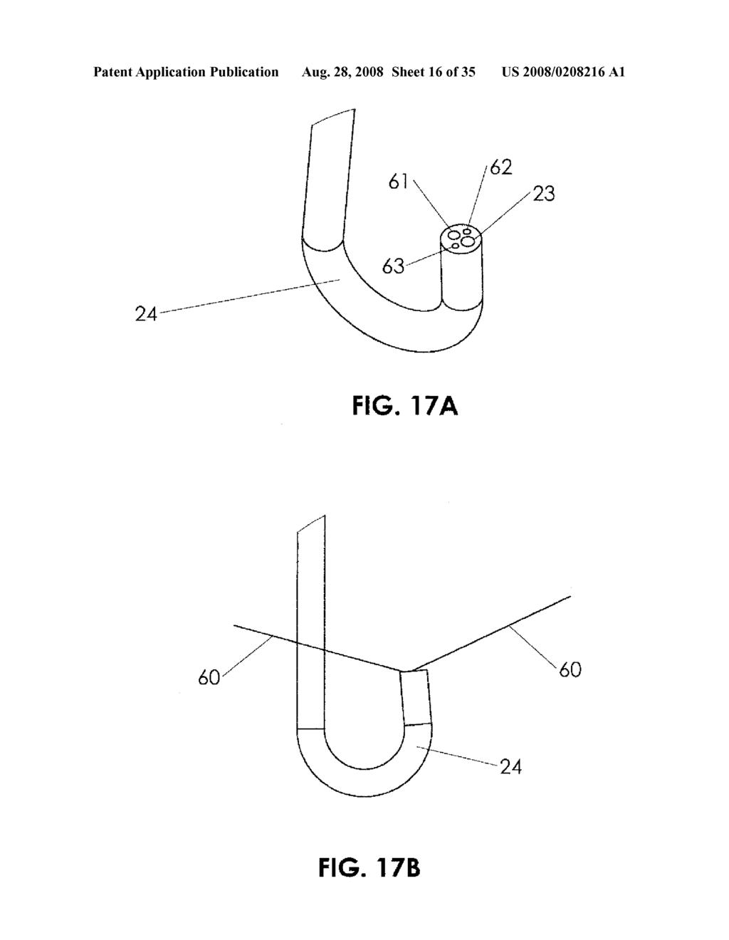 METHODS AND DEVICES FOR ENDOSCOPIC TREATMENT OF ORGANS - diagram, schematic, and image 17