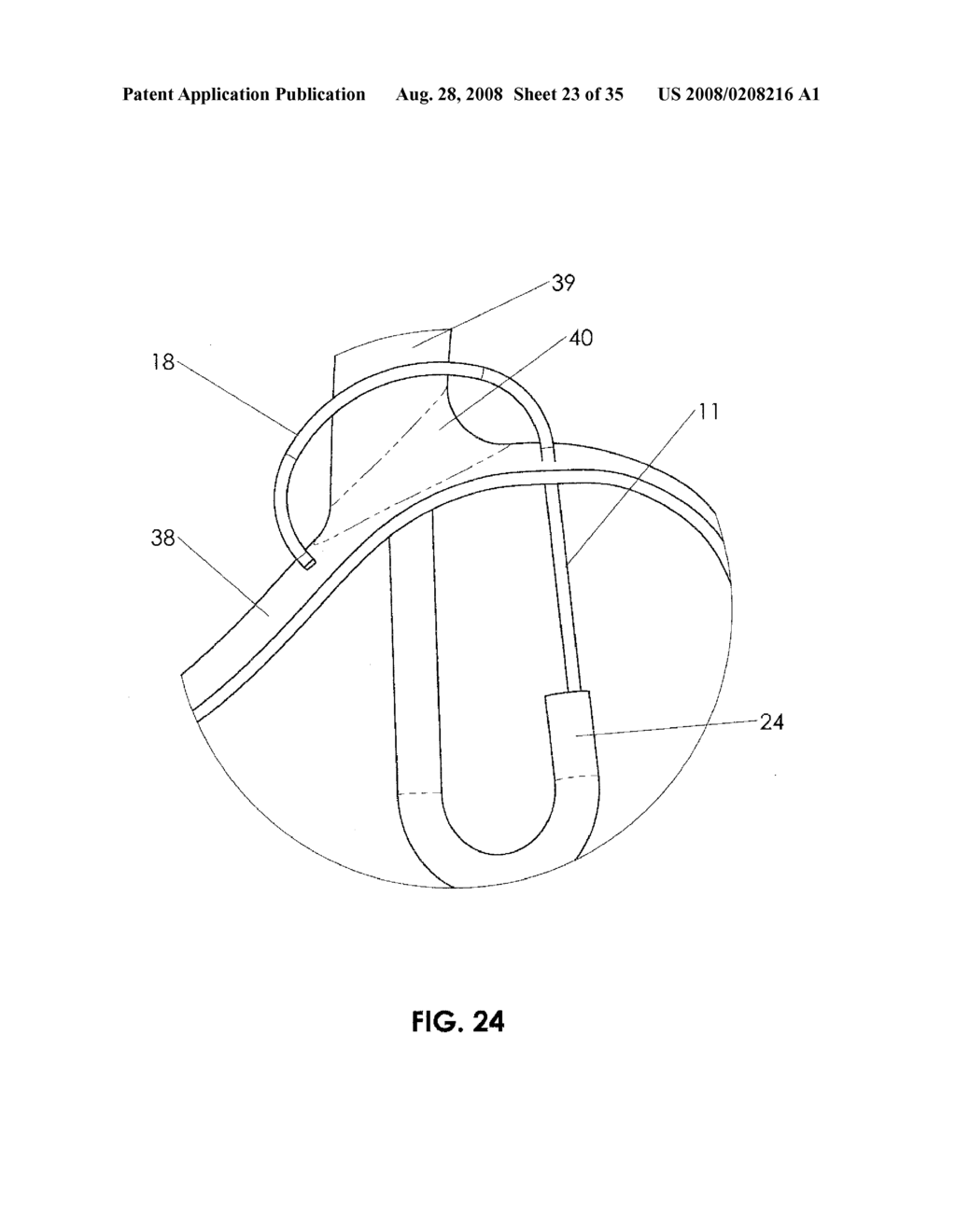 METHODS AND DEVICES FOR ENDOSCOPIC TREATMENT OF ORGANS - diagram, schematic, and image 24