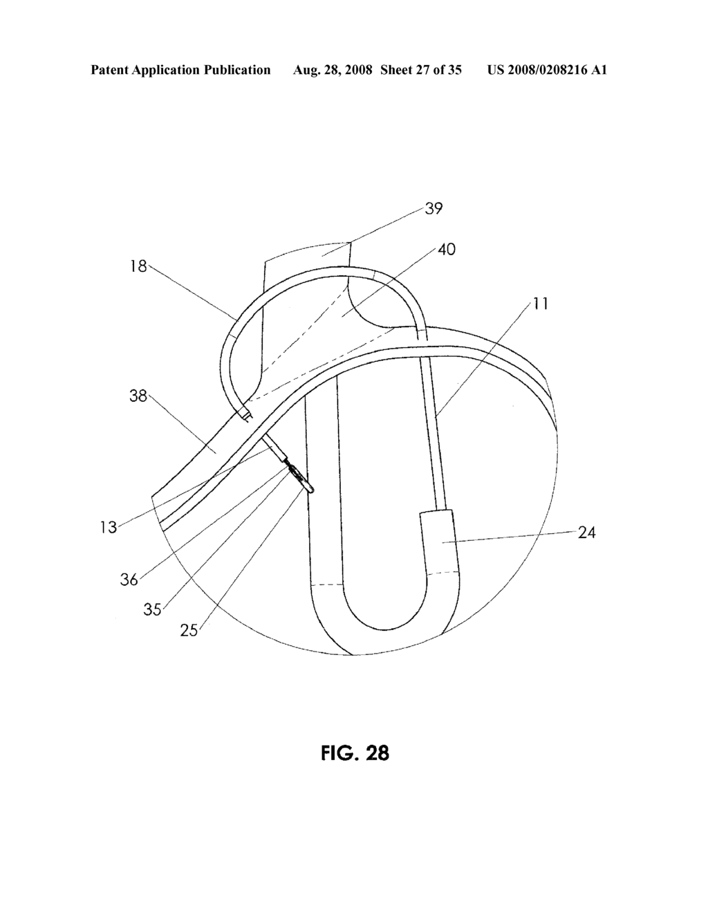 METHODS AND DEVICES FOR ENDOSCOPIC TREATMENT OF ORGANS - diagram, schematic, and image 28