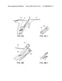 SUTURE PASSING INSTRUMENT AND METHOD OF PASSING SUTURE diagram and image