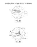SUTURE PASSING INSTRUMENT AND METHOD OF PASSING SUTURE diagram and image