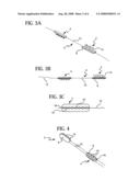 Device for attaching, relocating and reinforcing tissue and methods of using same diagram and image