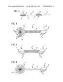 Device for attaching, relocating and reinforcing tissue and methods of using same diagram and image