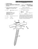 PEDICLE BASED SPINAL STABILIZATION WITH ADJACENT VERTEBRAL BODY SUPPORT diagram and image