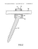 PEDICLE BASED SPINAL STABILIZATION WITH ADJACENT VERTEBRAL BODY SUPPORT diagram and image