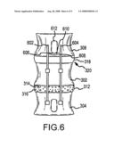 PEDICLE BASED SPINAL STABILIZATION WITH ADJACENT VERTEBRAL BODY SUPPORT diagram and image