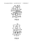 PEDICLE BASED SPINAL STABILIZATION WITH ADJACENT VERTEBRAL BODY SUPPORT diagram and image