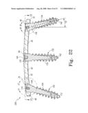Spine plate with configured bone screw bores diagram and image