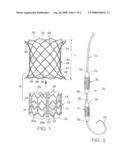 METHOD AND APPARATUS FOR REPLACING A PROSTHETIC VALVE diagram and image