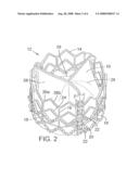 METHOD AND APPARATUS FOR REPLACING A PROSTHETIC VALVE diagram and image