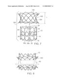 METHOD AND APPARATUS FOR REPLACING A PROSTHETIC VALVE diagram and image