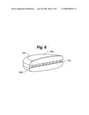 Interlocked modular disc nucleus prosthesis diagram and image