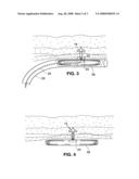 System and method for anchoring stomach implant diagram and image