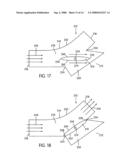 Flow diverter for controlling the pressure and flow rate in CPAP device diagram and image