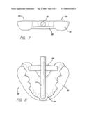 SLEEP APPLIANCE diagram and image