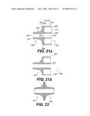 Mounting arrangement for a rotary valve diagram and image