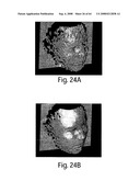 Methods and apparatus for 3D surface imaging using active wave-front sampling diagram and image