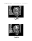 Methods and apparatus for 3D surface imaging using active wave-front sampling diagram and image