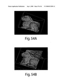 Methods and apparatus for 3D surface imaging using active wave-front sampling diagram and image