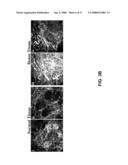 Use of Endogenous Fluorescence to Identify Invading Metastatic Breast Tumor Cells diagram and image