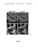 Use of Endogenous Fluorescence to Identify Invading Metastatic Breast Tumor Cells diagram and image