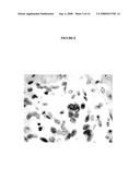 SITE-SPECIFIC ENZYMATIC DEPOSITION OF METAL IN SITU diagram and image