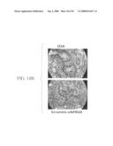 Methods and compositions for reducing activity of the atrial natriuretic peptide receptor and for treatment of diseases diagram and image