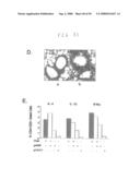 Methods and compositions for reducing activity of the atrial natriuretic peptide receptor and for treatment of diseases diagram and image