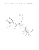 SPLITABLE TIP CATHETER WITH BIORESORBABLE ADHESIVE diagram and image