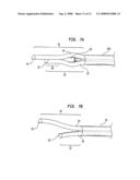 SPLITABLE TIP CATHETER WITH BIORESORBABLE ADHESIVE diagram and image