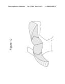 GELS WITH PREDETERMINED CONDUCTIVITY USED IN ELECTROPORATION OF TISSUE diagram and image