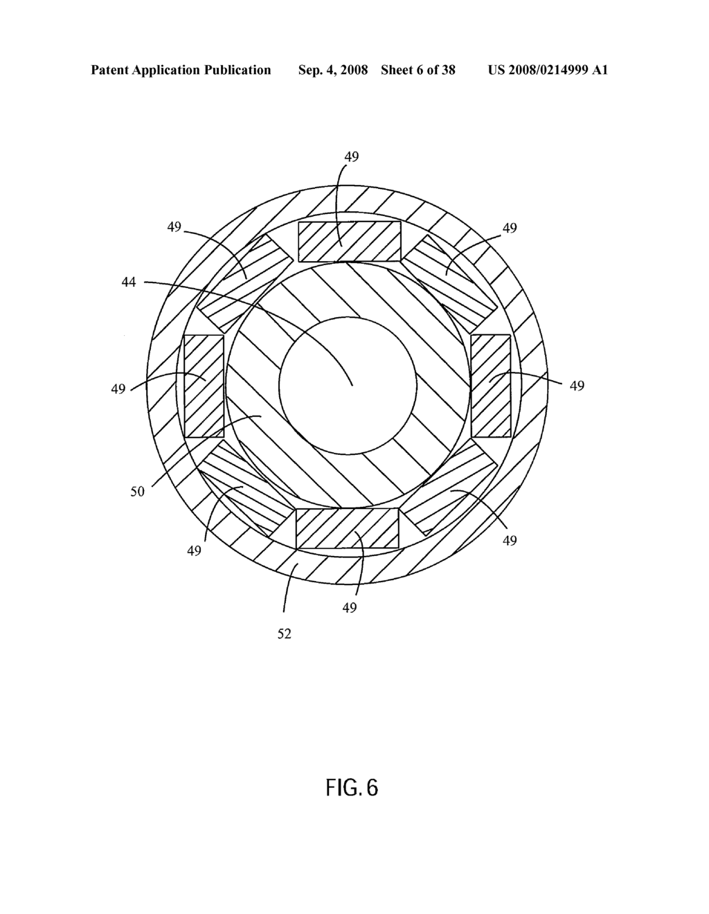 ANGIOPLASTY DEVICE AND METHOD OF MAKING SAME - diagram, schematic, and image 07