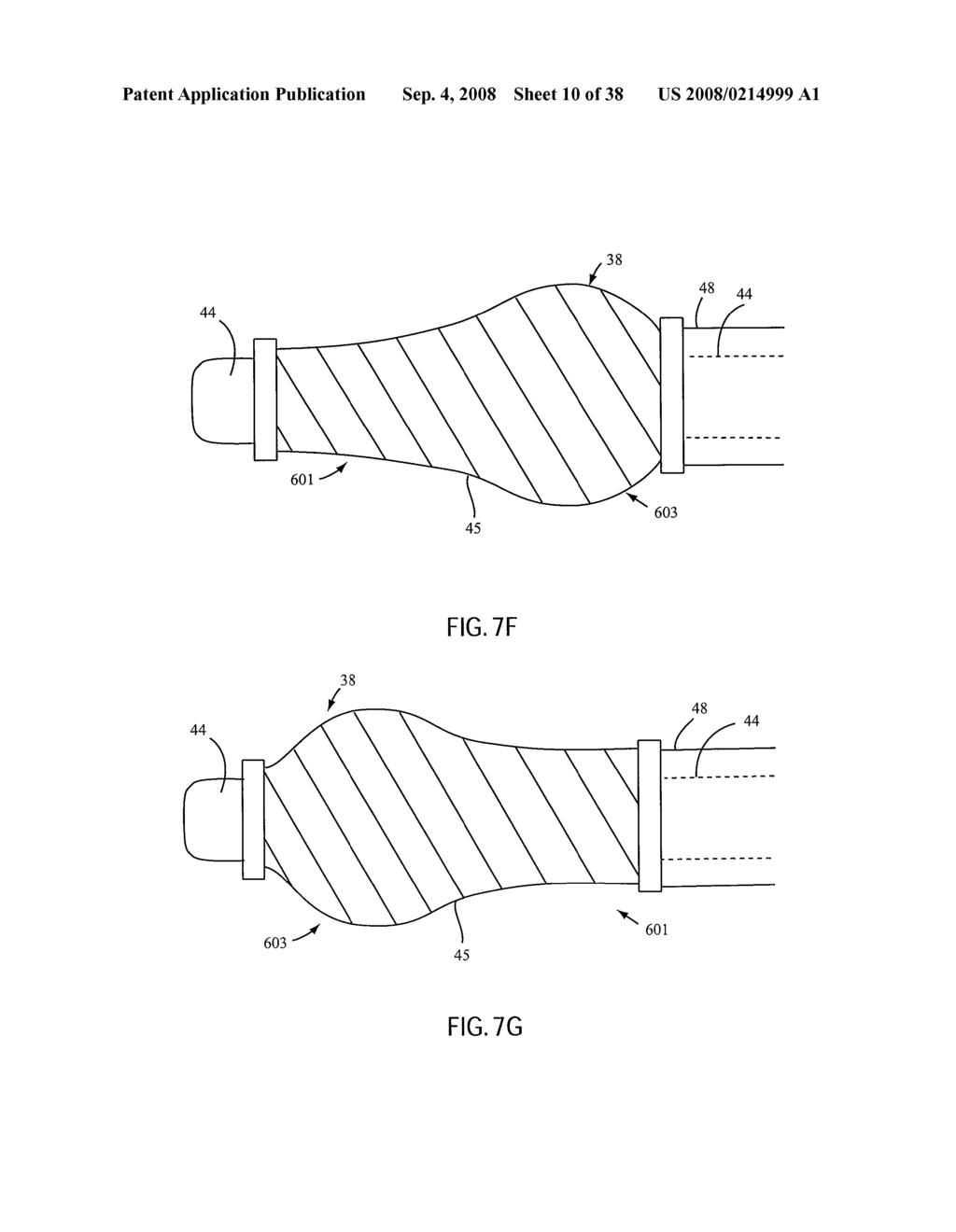 ANGIOPLASTY DEVICE AND METHOD OF MAKING SAME - diagram, schematic, and image 11