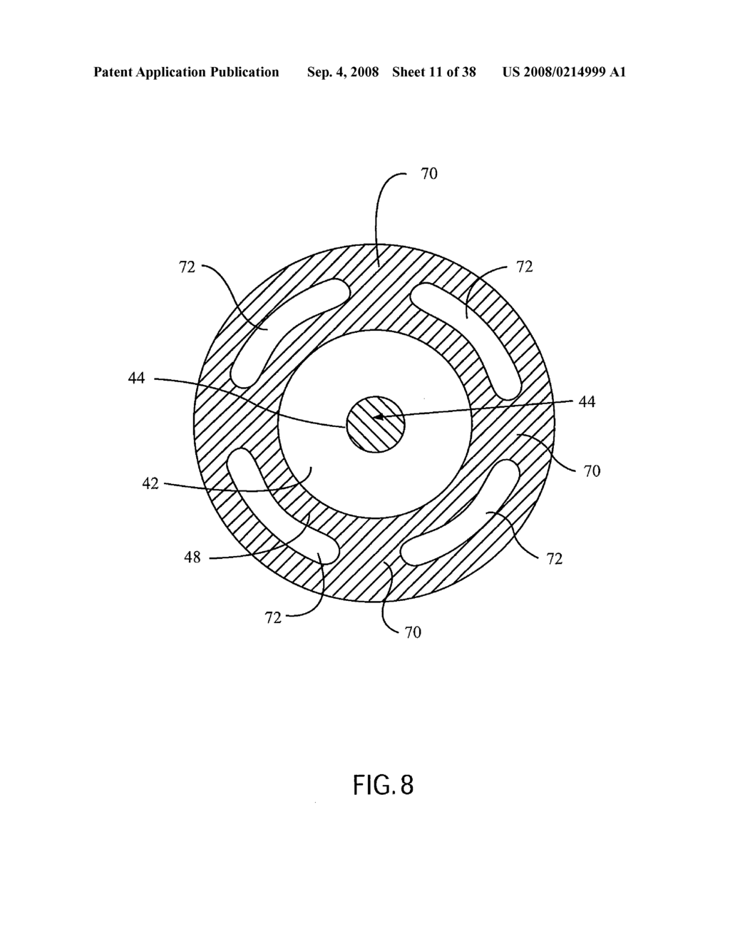 ANGIOPLASTY DEVICE AND METHOD OF MAKING SAME - diagram, schematic, and image 12