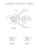 ANGIOPLASTY DEVICE AND METHOD OF MAKING SAME diagram and image