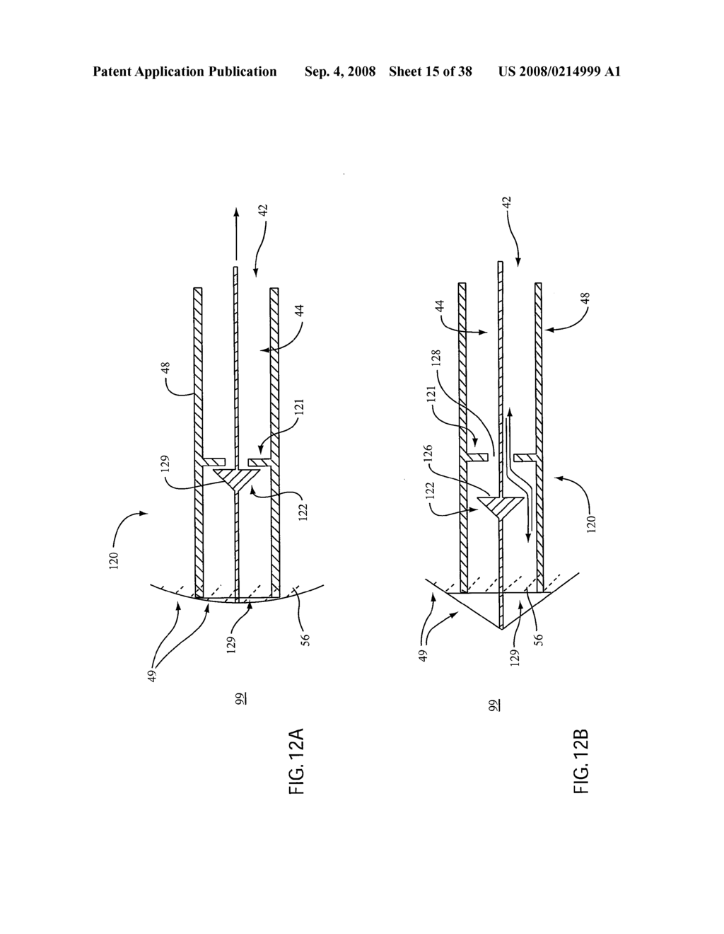 ANGIOPLASTY DEVICE AND METHOD OF MAKING SAME - diagram, schematic, and image 16