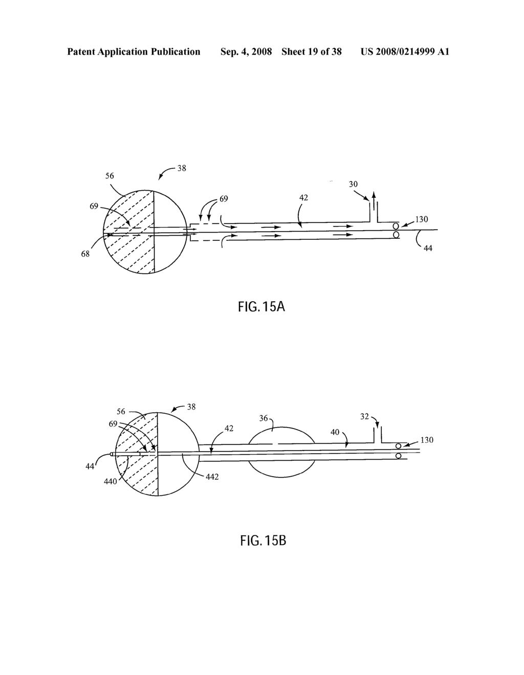 ANGIOPLASTY DEVICE AND METHOD OF MAKING SAME - diagram, schematic, and image 20