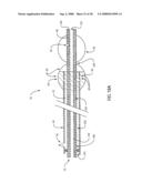 ANGIOPLASTY DEVICE AND METHOD OF MAKING SAME diagram and image