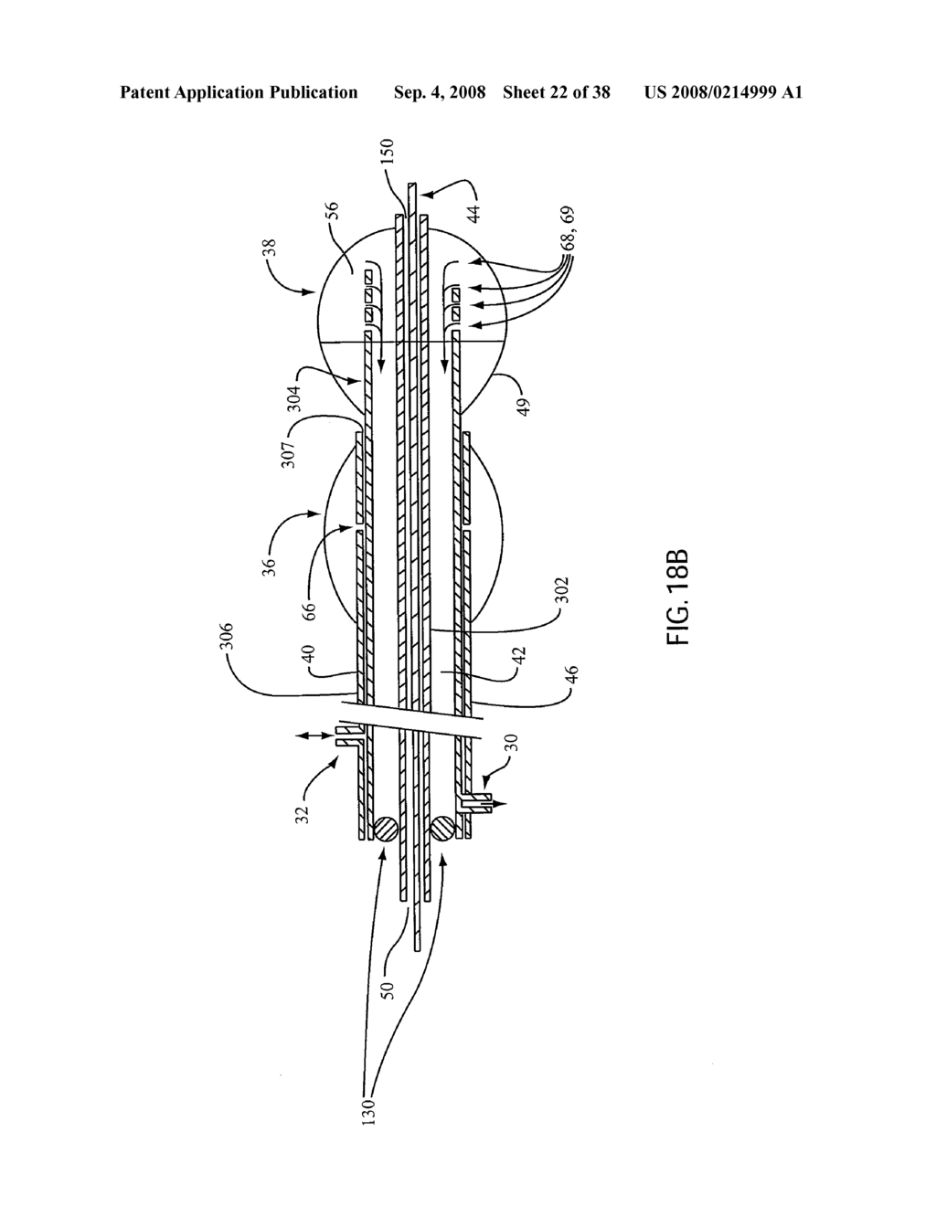 ANGIOPLASTY DEVICE AND METHOD OF MAKING SAME - diagram, schematic, and image 23