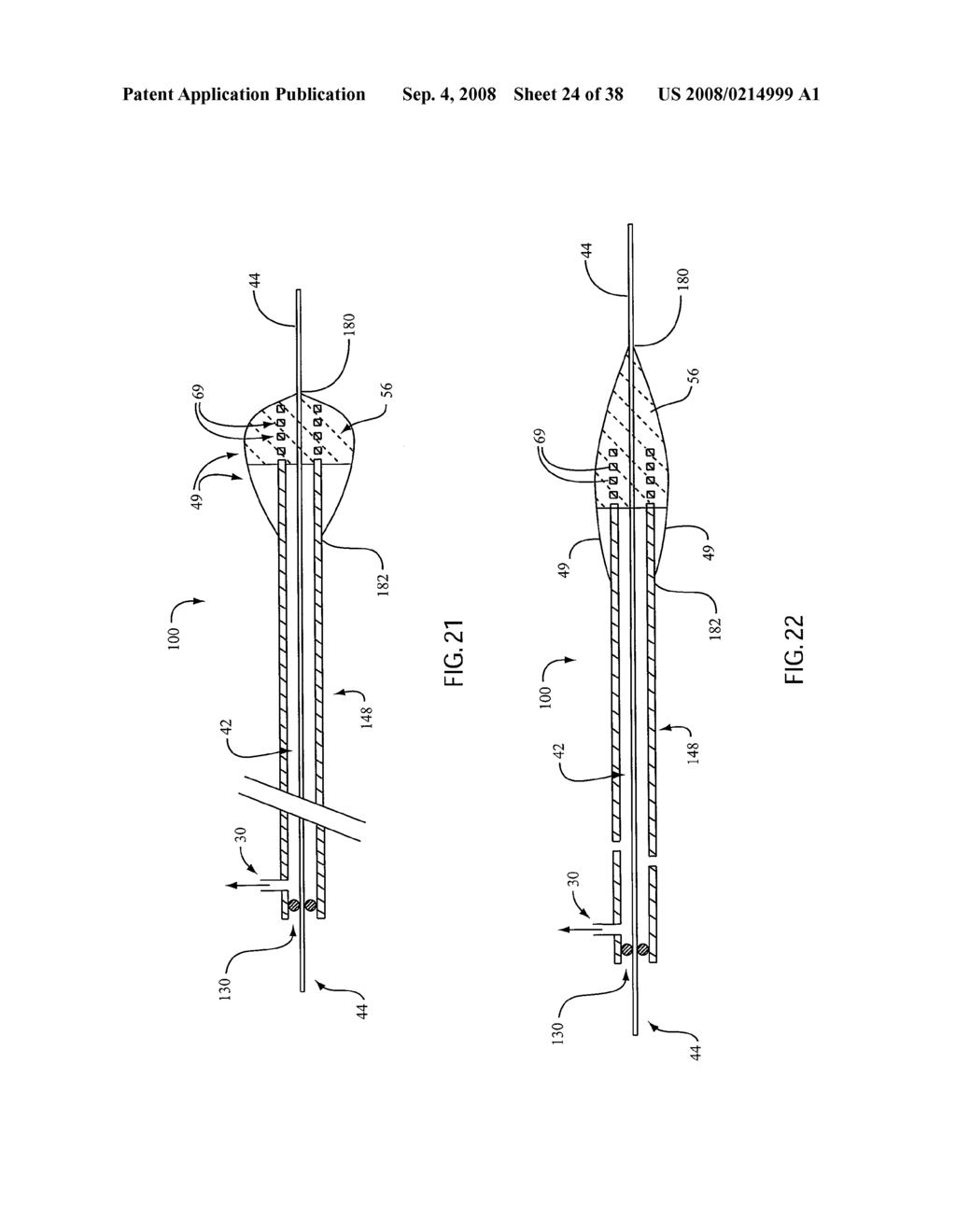 ANGIOPLASTY DEVICE AND METHOD OF MAKING SAME - diagram, schematic, and image 25