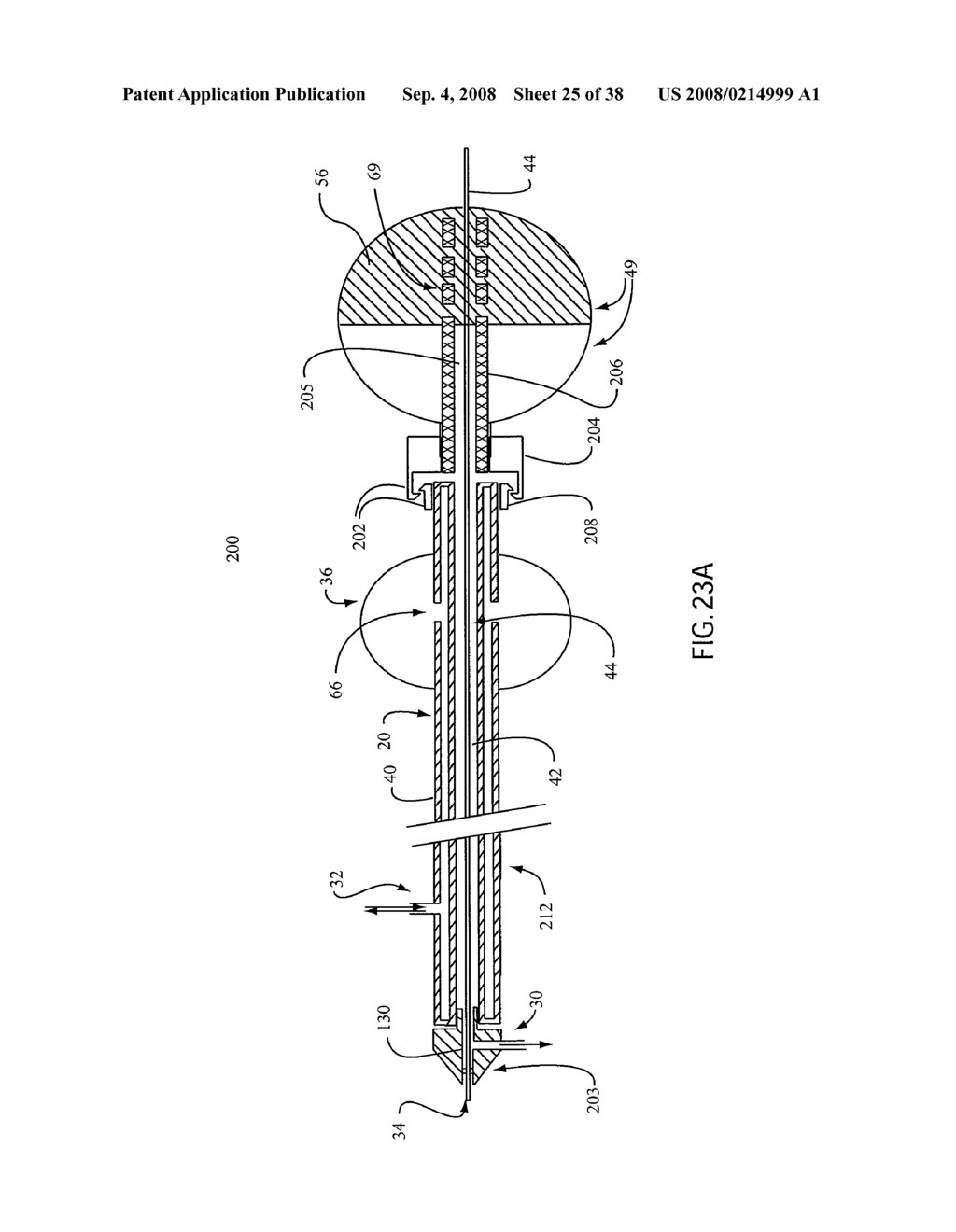 ANGIOPLASTY DEVICE AND METHOD OF MAKING SAME - diagram, schematic, and image 26