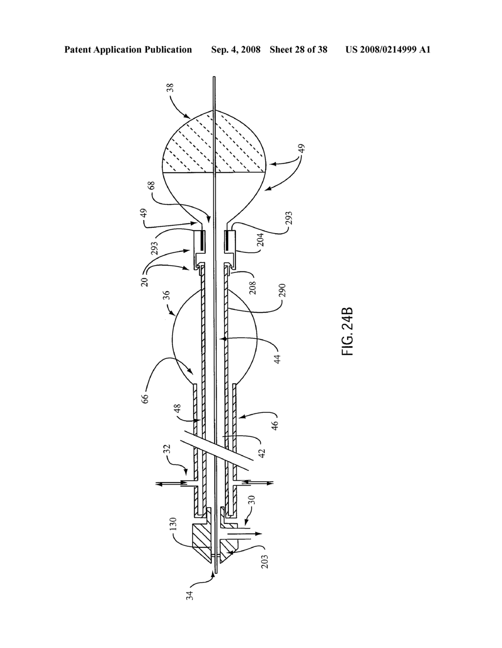 ANGIOPLASTY DEVICE AND METHOD OF MAKING SAME - diagram, schematic, and image 29