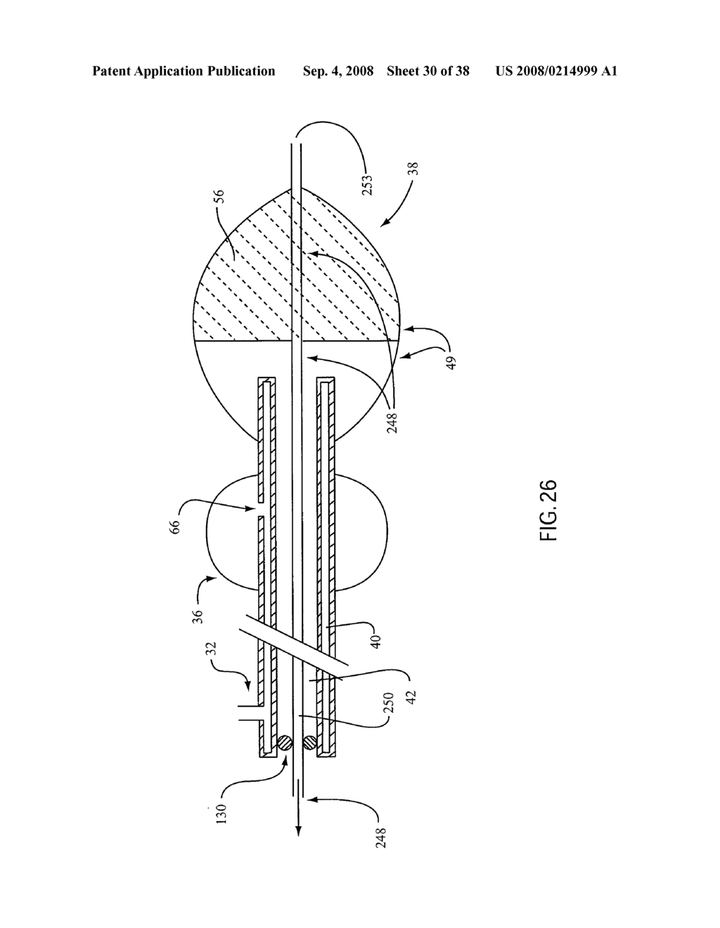 ANGIOPLASTY DEVICE AND METHOD OF MAKING SAME - diagram, schematic, and image 31
